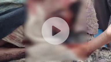 बिहारपुर: ग्राम रमकोला में भालू के हमले से गंभीर रूप से घायल हुआ ग्रामीण, पुटु खुखड़ी लेने जंगल गया था तभी हुआ हमला