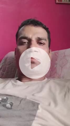 मुंह में छाले
Mouth ulcer 
 #mouthfreshner #mouthulcertreatment #mouthulcerrelief #mouthulcer #exercise #trendingreel
