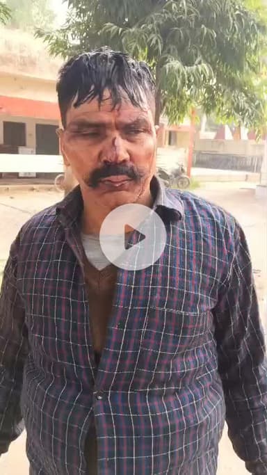 दबंग प्रधान व उसके पुत्रों ने  किया गांव के ही निवासी को लहुलुहान
ग्राम #pachpedwa