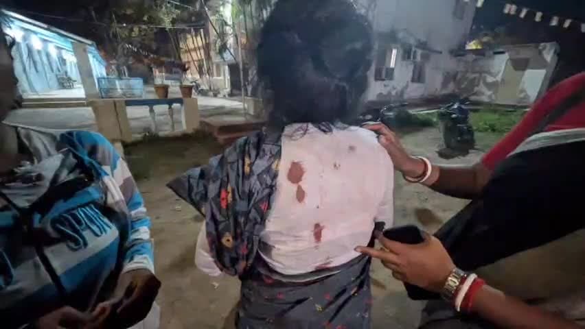 হিঙ্গলগঞ্জ: খেজুরবেড়িয়া এলাকায় আগুনে পুড়ে যাওয়া ক্ষতিগ্রস্ত বিজেপি কর্মীদের মারধর করল তৃণমূলের কর্মীরা