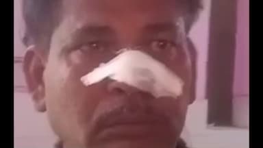 कायमगंज: कायमगंज बाईपास रोड चिलांका के पास पिकअप की टक्कर से बाइक सवार होमगार्ड घायल, अस्पताल में भर्ती