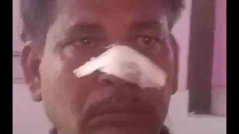 कायमगंज: कायमगंज बाईपास रोड चिलांका के पास पिकअप की टक्कर से बाइक सवार होमगार्ड घायल, अस्पताल में भर्ती