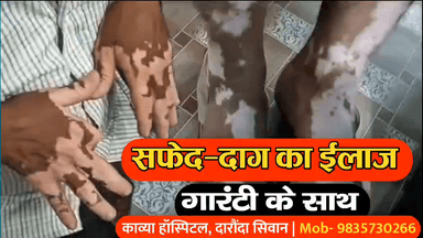 कोडरमा: सिवान जिले के काव्या सेवा सदन में सफेद दाग का गारंटी के साथ हो रहा है ईलाज, दवा का असर नहीं तो पैसा वापस | 9835730266