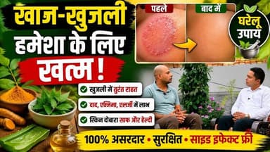 100% असरदार उपाय ! खाज, खुजली और फंगल इन्फेक्शन का घरेलू इलाज , खुजली का रामबाण इलाज #FungalInfection
#FungalInfectionTreatment
#DaadKhajKhujli
#KhajKhujli
#KhujliKaIlaj
#RingwormTreatment
#HomeRemedy
#SkinCare
#HealthTips
#GhareluUpay
#HindiHealthTips
#skininfectioncontrol