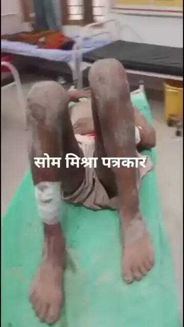 घर में घुसकर दंपति पर हमला, लाखों के जेवर व नकदी चोरी; सात नामजद सहित अन्य पर मुकदमा दर्ज