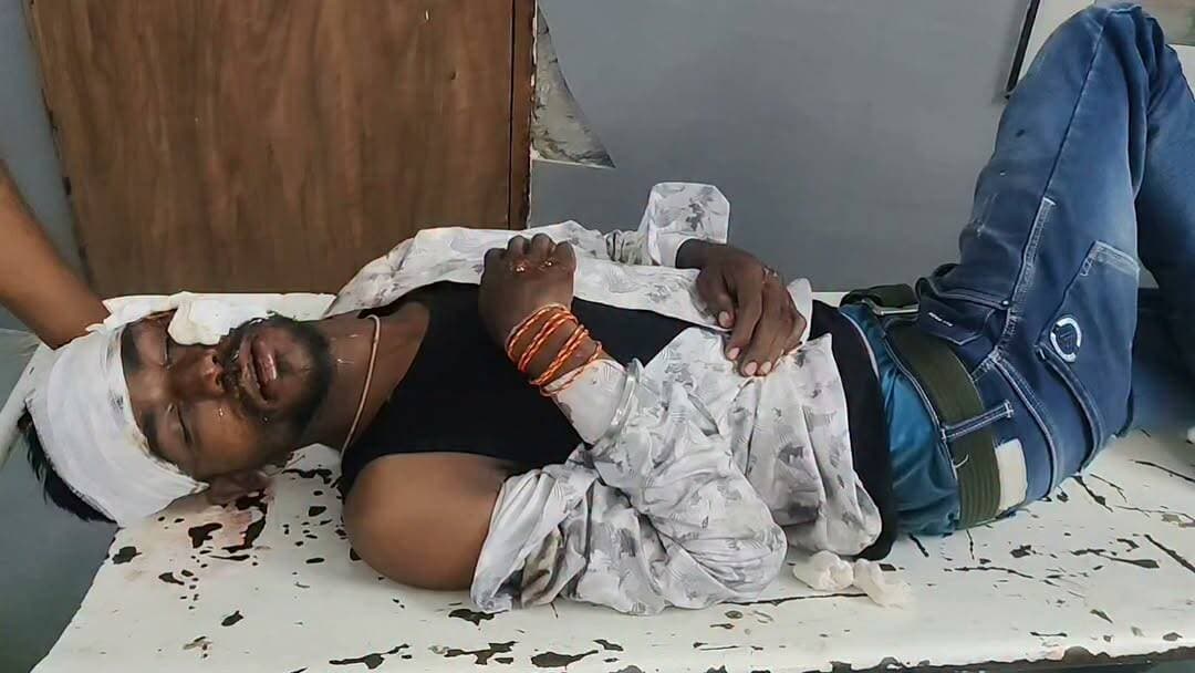 🚨 बैतूल ऑयल मिल के पास भीषण सड़क हादसा!
💥 दो बाइकों की आमने-सामने टक्कर, दो युवक घायल
⚠️ एक की हालत बेहद गंभीर, जिला अस्पताल में इलाज जारी
बैतूल शहर के कोतवाली थाना क्षेत्र अंतर्गत इटारसी रोड स्थित बैतूल ऑयल मिल के पास गुरुवार रात करीब 9:30 बजे दो बाइकों के बीच जोरदार भिड़ंत हो गई। टक्कर इतनी भीषण थी कि दोनों बाइक सवार सड़क पर गिरकर गंभीर रूप से घायल हो गए।
घायलों की पहचान चिचोली क्षेत्र के 27 वर्षीय जमना प्रसाद और 23 वर्षीय राजेश यादव के रूप में हुई है। हादसे में राजेश यादव की हालत अत्यधिक गंभीर बताई जा रही है, जबकि दोनों का उपचार जिला चिकित्सालय बैतूल में जारी है।
सूचना मिलते ही पुलिस और स्थानीय लोग मौके पर पहुंचे तथा घायलों को तत्काल अस्पताल पहुंचाया। पुलिस ने मामला दर्ज कर हादसे के कारणों की जांच शुरू कर दी है।
🙏 वाहन चलाते समय सावधानी बरतें, हेलमेट पहनें और यातायात नियमों का पालन करें।
#Betul #BetulNews #BreakingNews #RoadAccident #BikeAccident #MadhyaPradesh #KotwaliBetul #Chicholi #MPNews #HindiNews #TrendingNews #ViralNews #NewsUpdate #RoadSafety #StaySafe