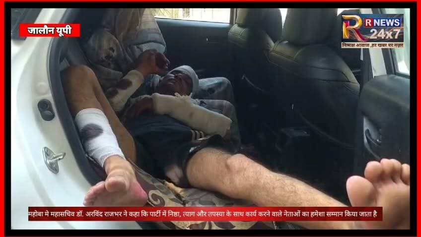 जालौन से इस वक्त की बड़ी खबर आ रही है
जालौन में युवक पर दिनदहाड़े जानलेवा हमला, हालत गंभीर
दो बाइकों पर सवार 6 दबंगों ने बीच रास्ते में घेरकर युवक पर लोहे की रॉड से किया ताबड़तोड़ हमला।
लहूलुहान हालत में न्याय की गुहार लगाने परिजन घायल युवक को गोद में लेकर पहुंचे थाना कदौरा
पीड़ित ने सुरौली गांव के रहने वाले 5 हमलावरों के खिलाफ नामजद तहरीर दी; पुलिस मामले की जांच और आरोपियों की तलाश में जुटी।
News Nation #jalaun #जालौन #बीजेपीसरकार #NewsAlert #jalaun Braking Yogi BJP Uttar Pradesh
