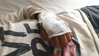 बारात देखने गए 14 वर्षीय किशोर पर जानलेवा हमला, पुरानी रंजिश में लाठी-डंडों से बेरहमी से पीटने का आरोप
पीड़ित परिवार ने राधानगर पुलिस पर एफआईआर दर्ज न करने और आरोपियों को छोड़ने का लगाया आरोप
पुलिस अधीक्षक से लगाई न्याय की गुहार, जान-माल की सुरक्षा और तत्काल कार्रवाई की मांग
✒️ रिपोर्ट अजय श्रीवास्तव
फतेहपुर (उत्तर प्रदेश) राधानगर थाना क्षेत्र के रमवां पंथुवा गांव में 14 वर्षीय किशोर पर कथित रूप से लाठी-डंडों से जानलेवा हमला किए जाने का मामला सामने आया है। पीड़ित पक्ष का आरोप है कि पुरानी रंजिश के चलते किशोर को बारात देखने के दौरान घेरकर बेरहमी से पीटा गया, जिससे उसके सिर और हाथ में गंभीर चोटें आईं। परिवार ने पुलिस पर एफआईआर दर्ज न करने और आरोपियों के खिलाफ कार्रवाई में लापरवाही बरतने का आरोप लगाया है। इन आरोपों की स्वतंत्र पुष्टि नहीं हुई है और पुलिस का विस्तृत पक्ष सामने आना शेष है।
फतेहपुर। राधानगर थाना क्षेत्र के रमवां पंथुवा गांव में एक 14 वर्षीय किशोर पर कथित रूप से पुरानी रंजिश के चलते जानलेवा हमला किए जाने का मामला सामने आया है। पीड़ित परिवार ने पुलिस अधीक्षक को शिकायती प्रार्थना पत्र देकर मुकदमा दर्ज कराने, आरोपियों की गिरफ्तारी तथा परिवार की सुरक्षा की मांग की है।
प्रार्थना पत्र के अनुसार, भोला पुत्र श्री शक्ति ने बताया कि उनका 14 वर्षीय पुत्र कुलदीप कुमार उर्फ रामदीन 7 जुलाई 2026 की शाम लगभग 6 बजे गांव में एक बारात देखने गया था। आरोप है कि पहले से घात लगाए बैठे धनंजय, सर्वेश और जियालाल ने उसे रोक लिया और पुरानी रंजिश के चलते गाली-गलौज करते हुए लाठी-डंडों से हमला कर दिया।
पीड़ित पक्ष का दावा है कि हमले में किशोर का सिर फट गया, हाथ का पंजा टूट गया और वह गंभीर रूप से घायल होकर बेहोश हो गया। शोर सुनकर ग्रामीण मौके पर पहुंचे तो आरोपी वहां से फरार हो गए। इसके बाद 112 एम्बुलेंस की सहायता से घायल किशोर को जिला अस्पताल में भर्ती कराया गया, जहां उसका उपचार जारी है।
शिकायतकर्ता ने आरोप लगाया है कि अगले दिन राधानगर थाने में शिकायत देने के बावजूद एफआईआर दर्ज नहीं की गई। उनका यह भी आरोप है कि पुलिस ने आरोपियों को थाने बुलाकर कुछ समय बाद छोड़ दिया। इन आरोपों की स्वतंत्र पुष्टि नहीं हुई है।
परिवार का कहना है कि आरोपी अब भी घर पहुंचकर धमकी दे रहे हैं और शिकायत वापस लेने का दबाव बना रहे हैं। इसी कारण पीड़ित पक्ष ने पुलिस अधीक्षक से मामले में निष्पक्ष जांच, तत्काल एफआईआर दर्ज करने, आरोपियों की गिरफ्तारी और परिवार की सुरक्षा सुनिश्चित करने की मांग की है।
फिलहाल इस मामले में पुलिस की ओर से कोई विस्तृत आधिकारिक बयान सार्वजनिक नहीं हुआ है। जांच के बाद ही पूरे घटनाक्रम की स्पष्ट स्थिति सामने आएगी।
नाबालिगों से जुड़े हिंसक मामलों में त्वरित चिकित्सीय सहायता, निष्पक्ष जांच और समयबद्ध कानूनी कार्रवाई अत्यंत महत्वपूर्ण होती है। यदि पीड़ित पक्ष द्वारा लगाए गए आरोप सही पाए जाते हैं तो संबंधित व्यक्तियों के विरुद्ध कानून के अनुसार कार्रवाई की जानी चाहिए। वहीं जांच पूरी होने से पहले किसी भी पक्ष को दोषी मानना उचित नहीं होगा।
🟥 ND NEWS | दैनिक निष्पक्ष धारा की अपील
एनडी न्यूज़ एवं दैनिक निष्पक्ष धारा जिला पुलिस प्रशासन से अपील करता है कि मामले की निष्पक्ष, पारदर्शी और समयबद्ध जांच कराई जाए। यदि शिकायत में लगाए गए आरोप सही पाए जाते हैं तो दोषियों के विरुद्ध कठोर वैधानिक कार्रवाई सुनिश्चित की जाए। साथ ही पीड़ित परिवार की सुरक्षा और घायल किशोर को समुचित चिकित्सा उपलब्ध कराई जाए।
👇👇👇
#NDNews #Fatehpur #Radhanagar #RamwanPanthuwa #CrimeNews #UPPolice #JusticeForVictim #LawAndOrder #BreakingNews #PoliceInvestigation
👇👇
@dgpup
@RSSorg
@UPGovt
@wpl1090
@RSSgeet
@Uppolice
@MIB_India
@PMOIndia
@HMOIndia
@abmanglik
@VHPDigital
@igrangealld
@myogioffice
@InfoDeptUP
@dmfatehpur
@sdmsadarftp
@CMOfficeUP
@CMOUP_RC
@ChiefSecyUP
@ChiefSecyUP
@MahantYogiG
@FatehpurSdm
@fatehpurpolice
@BajrangDalOrg
@rashtrapatibhvn
@UPMahilaKalyan
@112UttarPradesh
@myogiadityanath
@CommissionerPrg
@ADGZonPrayagraj
👇👇👇
🟥 ND NEWS | दैनिक निष्पक्ष धारा
मुख्य संपादक / संस्थापक: राजन सिंह हाड़ा
सह-संपादक: शालिनी सिंह भदौरिया
📍 कार्यालय-3: U158, हीरा स्वीट्स के पास, विकास मार्ग, लक्ष्मी नगर, पूर्वी दिल्ली,110092 (NCR)
📍 कार्यालय-2: विधानसभा रोड, बर्लिंगटन चौराहा,लखनऊ – 226001 (UP)
📍 कार्यालय-1: 1/1 अटल बिहारी चौराहा, नियर बर्मा चौराहा, फतेहपुर – 212601 (UP)
📅 दिनांक: 09 जुलाई 2026
📆 दिन: गुरुवार
📧 Email: ndnewschannel@gmail.com
📞 मोबाइल: 9696119696