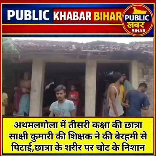 #अथमलगोला में तीसरी कक्षा की छात्रा साक्षी कुमारी की शिक्षक ने की बेरहमी से पिटाई,छात्रा के शरीर पर चोट के निशान,SDM ने दिए जाँच के आदेश।