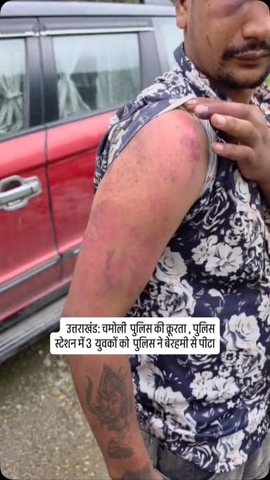 उत्तराखंड: चमोली पुलिस की क्रूरता , पुलिस स्टेशन में 3 युवकों को थानाअध्यक्ष लक्ष्मीप्रसाद बिजलवान और अन्य पुलिसकर्मियों ने बेरहमी से पीटा