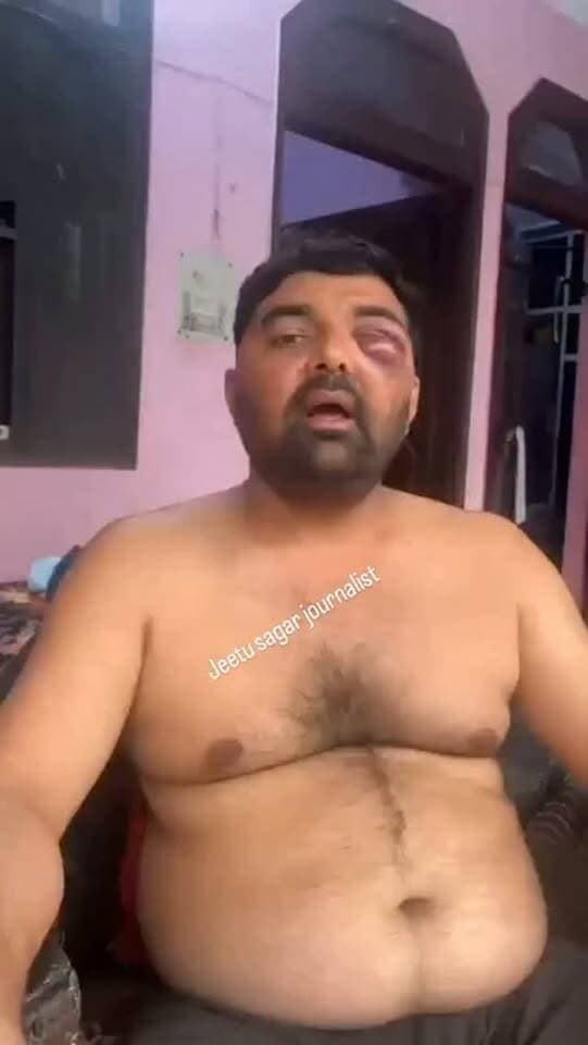 दिग्विजय भाटी और मोहित जाटव की पिटाई का आरोप। SSP पांडे ने अपने चैंबर में डेढ़ घंटे तक दलित नेता को पीटा