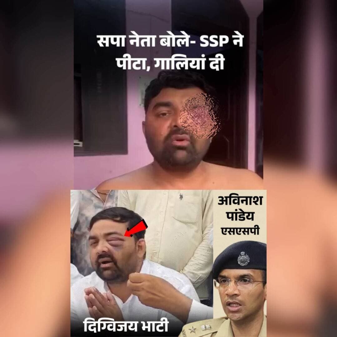सपा नेता फूट-फूटकर रोया, बोला- SSP ने बूटों से मारा:'चोली के पीछे क्या है...' गाने पर नचवाया;
मेरठ में चोटिल आंखों पर पट्टी बांधकर प्रेस कॉन्फ्रेंस की,
पुलिस बोली- स्कूटी से गिरने पर लगी चोट
मेरठ में ललिता गौतम हत्याकांड को लेकर प्रदर्शन के बाद सपा नेता डॉ. दिग्विजय भाटी और मोहित जाटव ने तत्कालीन SSP अविनाश पांडेय पर हिरासत में मारपीट करने के गंभीर आरोप लगाए हैं। शुक्रवार को दिग्विजय चोटिल आंख पर पट्टी बांधकर सपा विधायक अतुल प्रधान के आवास पर पहुंचे और प्रेस कॉन्फ्रेंस में रोते हुए अपनी आपबीती बताई।
‘चैंबर में ले जाकर बूटों से पीटा’
दिग्विजय भाटी का आरोप है कि 19 अगस्त को वह और मोहित जाटव अपनी बात रखने SSP से मिलने गए थे। उनके मुताबिक, SSP ने गाली-गलौज की और दोनों को चैंबर में ले जाकर लात-घूंसों और बूटों से पीटा।
उन्होंने आरोप लगाया कि बाद में उन्हें SOG कार्यालय ले जाया गया, जहां हाथ-पैर बांधकर डंडों से भी पीटा गया। उनका दावा है कि रात करीब 2 बजे सपा विधायक अतुल प्रधान के पहुंचने के बाद उन्हें छोड़ा गया।
दिग्विजय ने यह भी आरोप लगाया कि उनके साथ कथित तौर पर अभद्र गाने पर नचाने जैसा व्यवहार किया गया।
‘SSP ने एनकाउंटर की योजना बनाई थी’
मोहित जाटव ने आरोप लगाया कि SSP ने पुलिसकर्मियों से उनके एनकाउंटर की बात कही थी। हालांकि, इस आरोप की स्वतंत्र पुष्टि अभी नहीं हुई है।
सपा विधायक अतुल प्रधान ने पूरे मामले में SSP और इंस्पेक्टर के खिलाफ मुकदमा दर्ज करने की मांग की है। उन्होंने दावा किया कि दोनों से जबरन ऐसा पत्र लिखवाया गया जिसमें चोटें स्कूटी से गिरने के कारण होना बताया गया।
पुलिस का दावा- आरोप निराधार, स्कूटी से गिरने पर लगी चोट
मेरठ पुलिस ने सपा नेताओं के आरोपों को निराधार बताया है। पुलिस के मुताबिक, दोनों के खिलाफ पहले से कई आपराधिक मुकदमे दर्ज हैं और वे हिस्ट्रीशीटर हैं। पुलिस का दावा है कि उन्हें चोटें स्कूटी से गिरने के कारण आई हैं।
इंस्पेक्टर अखिलेश कुमार गौड़ ने कहा कि वह बाद में मौके पर पहुंचे थे और उन्होंने कप्तान के आदेश का पालन किया।
मामले की गंभीरता को देखते हुए ADG मेरठ भानु भास्कर ने सहारनपुर DIG अभिषेक सिंह को जांच सौंपी है। वहीं, अविनाश पांडेय को मेरठ SSP पद से हटाकर पुलिस मुख्यालय से संबद्ध किया जा चुका है।
विवाद की शुरुआत ललिता गौतम हत्याकांड से हुई थी
बीए की छात्रा ललिता गौतम 15 मई को परीक्षा देने घर से निकली थीं, लेकिन वापस नहीं लौटीं। 17 मई को रोहटा क्षेत्र के गन्ने के खेत में उनका शव मिला था। परिजनों ने गैंगरेप और हत्या का आरोप लगाते हुए प्रदर्शन किया था।
पुलिस ने जांच के बाद मुख्य आरोपी अंकुश समेत अन्य आरोपियों को गिरफ्तार किया। 8 जुलाई को परिजनों ने मेरठ कलेक्ट्रेट के बाहर प्रदर्शन किया था। आरोप है कि इसी दौरान तत्कालीन SSP अविनाश पांडेय ने प्रदर्शनकारियों के साथ मारपीट की थी।
फिलहाल सपा नेताओं और पुलिस के आरोपों की जांच DIG स्तर के अधिकारी कर रहे हैं। जांच रिपोर्ट के बाद ही यह स्पष्ट होगा कि मारपीट और हिरासत में कथित बर्बरता के आरोपों में कितनी सच्चाई है।