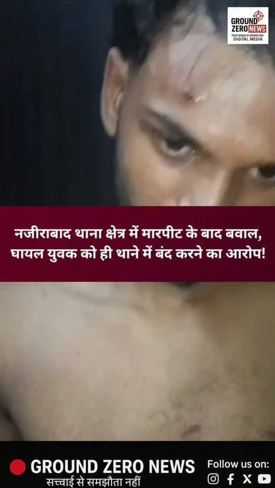 कानपुर | नजीराबाद थाना क्षेत्र
मारपीट में घायल युवक को ही थाने में बंद करने का आरोप, पुलिस कार्रवाई पर उठे सवाल!
नजीराबाद थाना क्षेत्र के सरोजनी नगर इलाके में पड़ोस में रहने वाले लोगों द्वारा विशाल सरोज के साथ मारपीट किए जाने का आरोप है। पीड़ित पक्ष के मुताबिक, मारपीट में विशाल को चोटें आईं और उसने 112 नंबर पर सूचना देकर पुलिस बुलाई।
आरोप है कि पुलिस विशाल को थाने ले गई और वहीं उसे बंद कर दिया। इसके बाद उसके मम्मी-पापा थाने पहुंचे, जिसके बाद विशाल को छोड़ दिया गया। वहीं, आरोप है कि बाद में विशाल के पिता को रात में थाने में बंद किया गया और अगले दिन शाम करीब 5 बजे धारा 151 के तहत कार्रवाई कर छोड़ दिया गया।
पीड़ित पक्ष का आरोप है कि विशाल का मेडिकल नहीं कराया गया और जिन लोगों पर मारपीट का आरोप है, उनके खिलाफ भी कोई कार्रवाई नहीं की गई।
अब सवाल नजीराबाद पुलिस की कार्रवाई पर उठ रहे हैं। हालांकि, मामले में पुलिस का आधिकारिक पक्ष सामने नहीं आया है। जांच और
