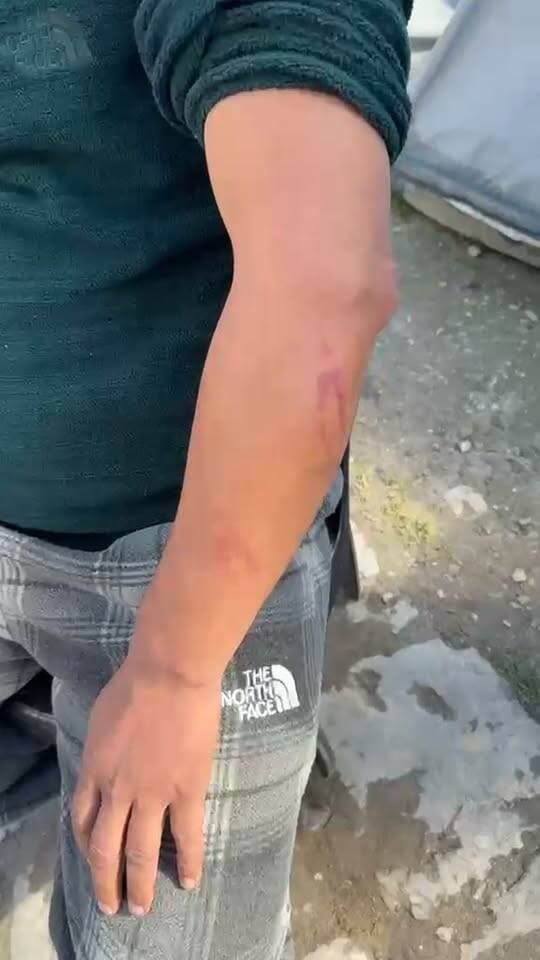 केदारनाथ धाम में ललित महाराज पर लगा मारपीट का आरोप,, स्थानीय व्यक्ति ने की पुलिस में शिकायत,,, तीर्थ पुरोहित समाज में आक्रोश।।