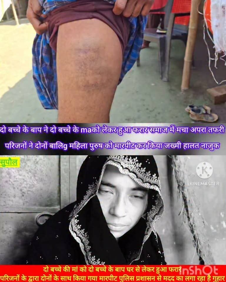 दो #बच्चे के #बाप ने दो बच्चे के #माँ को लेकर हुआ #फरार परिजनों ने मारपीट कर किया #जख्मी दोनों #मलिग महिला #पुरुष का #हालत #नाजुक
