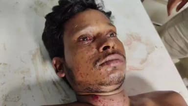 आरा: जिले के मुफस्सिल थाना क्षेत्र के श्रीनगर भकुरा गांव में गुरुवार शाम मामूली विवाद पर भाई ने छोटे भाई को गोली मारी