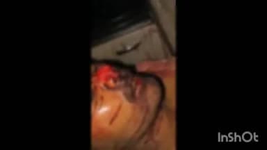 जैसलमेर: पोकरण में युवक की नाक काटने का सनसनीखेज मामला, पुलिस बदमाशों की तलाश कर रही है
